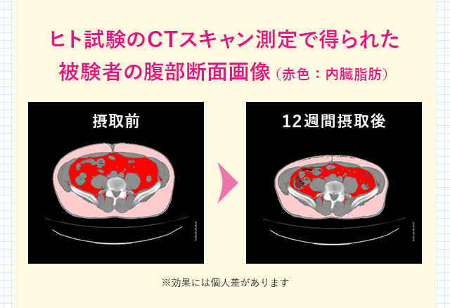 ヒト試験のCTスキャン測定で得られた被験者の腹部断面画像 ※効果には個人差があります